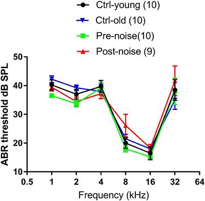 Synaptopathy in Guinea Pigs Induced by Noise Mimicking Human Experience and Associated Changes in Auditory Signal Processing